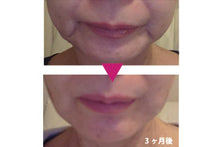 画像をギャラリービューアに読み込む, 【福岡市 中央区大名】「小顔矯正&全身ダイエット矯正」コース(60分) 小顔&脂肪取り専門店 【フィレンツェ】 特別価格 4,980円!