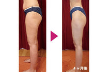 画像をギャラリービューアに読み込む, 【福岡市 中央区大名】「小顔矯正&全身ダイエット矯正」コース(60分) 小顔&脂肪取り専門店 【フィレンツェ】 特別価格 4,980円!