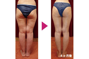 福岡市 中央区大名】「小顔矯正&全身ダイエット矯正」コース（60